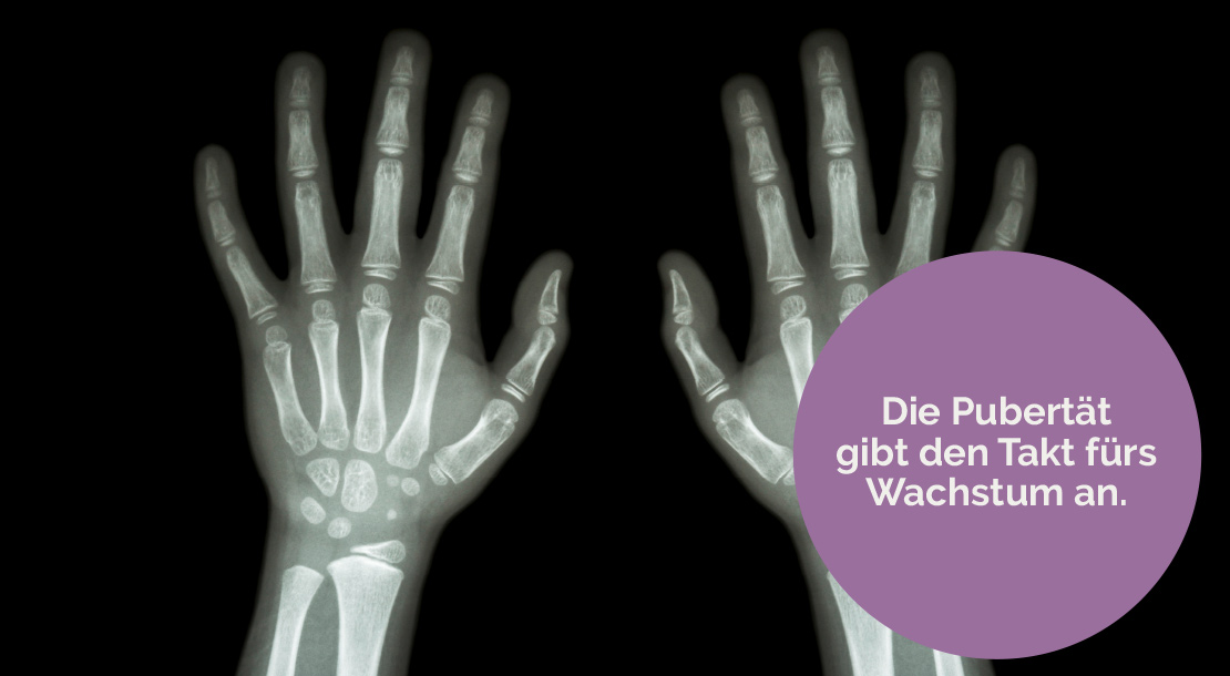 Werden meine Hände und Handgelänke größer? (Pubertät, Wachstum, Hand)